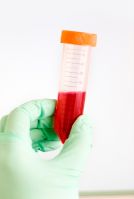 Blood Transfusion